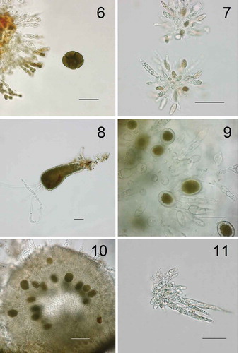 Figs 6–11. Conceptacle structure and germling growth. Fig. 6. Mature oogonium containing egg cells ready to be released; Figs 7-8. Antheridia (Fig. 7) and germlings (Fig. 8) after 6 days in culture from Locality 1 (Illaunnginga) (possible damage to the attachment rhizoids due to transfer to microscope slide). Fig. 9. Immature oogonia from Locality 2 (Clifden). Fig. 10. Immature oogonia. Fig. 11. Antheridia both from Locality 3 (Achill Sound). Scale bar is 50 μm.