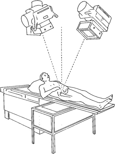 Figure 2. A uniplanar RSA arrangement. Two X-ray tubes are focused on the joint under examination. A calibration cage is placed underneath the X-ray table. It holds two X-ray films positioned next to each other.