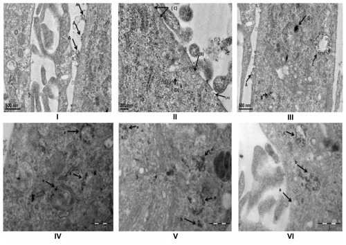 Figure 4 TEM Studies of interaction of FA-SPION with MCF-7 cells. (I) (A) Attachment of FA-SPION on the cell membrane of MCF-7. (II) (A) Pit formation started (B) Clathrin Pit almost completed (C) multiple pits on the membrane (D) SPION inside the lysosome and start of coalescing of multiple vesicles. (III) (A) SPION in the pit (B) SPION inside the lysosome (C) Multi vesicular body (MVB) filled with SPION (D) aggregated SPION inside the mature lysosomes. (IV) (a) SPIONs inside the different stages of lysosomes. (V) (a) Aggregation of SPION in lysosomes (b) SPION in the cytoplasm (outside lysosomes). (VI) (a) clathrin pit (b) ruptured MVB’s with SPIONS (possible entry of SPIONs to cytoplasm) (c) Multi Vesicular Body (MVB’s).Abbreviations: MCF-7, hormone dependent breast carcinoma cells; FA-SPIONs, Folic acid conjugated superparamagnetic iron oxide nanoparticles; MVB’s, multi vesicular bodies; FA-SPIONs, folic acid conjugated superparmagnetic iron oxide nanoparticles; SPION, superparamagnetic iron oxide nanoparticles.