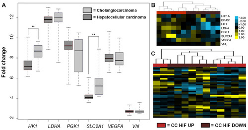 Figure 4 Genes specific to the hypoxia response show variable expression between human HCC and CC.