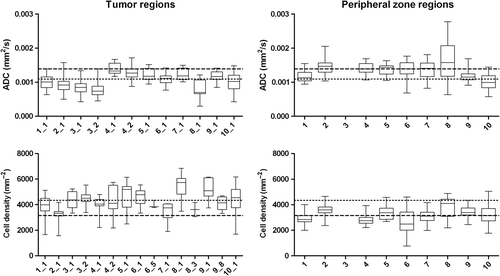 Figure 3. Boxplots of ADC and cell density for tumour and peripheral zone regions. Boxes are per patient with patient 3 and 4 having two separate tumour regions. Dotted line: median value of all tumour regions. Dashed line: median value of all peripheral zone regions.