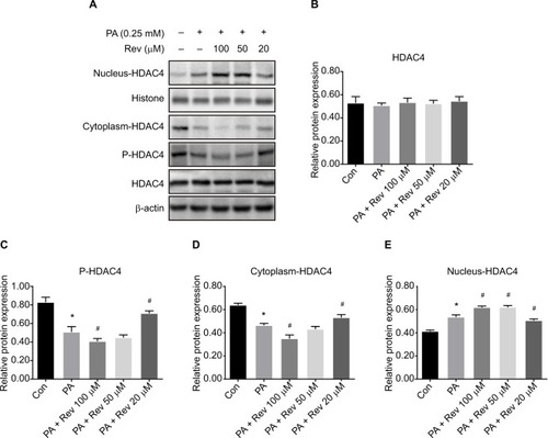 Figure 5 HDAC4 nucleus–cytoplasm translocation after resveratrol treatment.