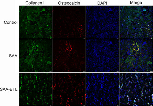 Figure 4 Immunofluorescence analysis of collagen II and osteocalcin expression in fracture calluses at the 4th week post-surgery. Osteocalcin and collagen II expression were quantified in sections of the callus. These data are shown in Figure 7B.