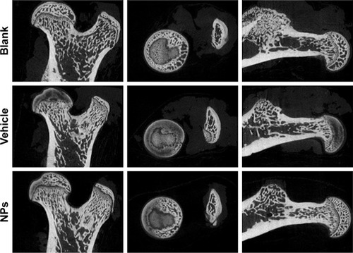 Figure 4 Se@SiO2 nanocomposites reduced MPS-induced osteonecrosis in the femoral head.Note: Two-dimensional pictures of normal bone from normal rats and osteonecrotic bones from rats in the MPS and MPS+Se@SiO2 groups.Abbreviations: MPS, methylprednisolone; NPs, nanoparticles.