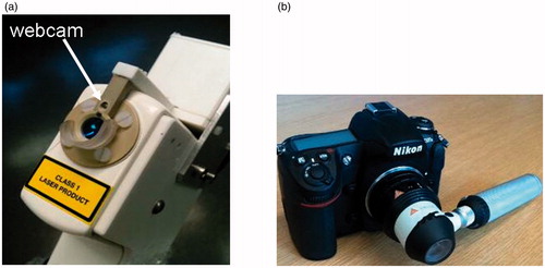 Figure 1. (a) The hand-held OCT probe from the VivoSight 1500 OCT system fitted for this study with a miniature webcam (arrowed), and (b) the Heine Delta 20 dermoscopic attachment to the Nikon DS300 digital camera.