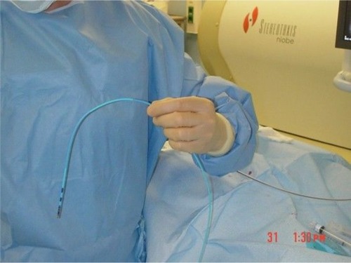 Figure 2 Irrigated magnetic catheter with three magnets built into the catheter’s tip.