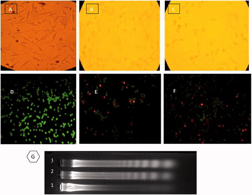 Figure 5. (UP) Inverted microscopic images of MDA-MB-231 Cells. (A) control, (B) and (C) treated with LD50 concentrations of CdNPs and CdNPs@BSA for 24 h, respectively. Middle) Fluorescent microscopy of cells stained with acridine orange/ethidium bromide. (D) control, (E) and (F) treated with CdNPs and CdNPs@BSA, respectively. (Down) DNA ladder on agarose gel electrophoresis. MDA-MB-231 Cells were treated with LD50 concentrations of CdNPs and CdNPs@BSA for 24 h and DNA fragmentation was analyzed. Lane M: 1 kB ladder, lane 1: control, lane 2: CdNPs, lane 3: CdNPs@BSA.