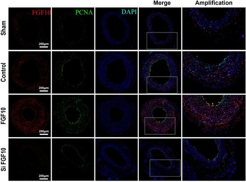 Figure 7 PCNA expressions were upregulated by FGF10 in vivo. The balloon injuries were performed in rat LCA with or without deliveries of exogenous FGF10 or siFGF10-2 and the whole LCA were harvested on day 14 post the procedure for staining of FGF10, PCNA and DAPI. Bar=200μm. n=5.