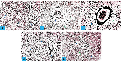 Figure 5. Composite photomicrographs of non-diabetic and diabetic pig liver showing normal distribution of the reticular fibers of the hepatocyte (blue arrow) (a); reticular fiber loss (green arrow) b; and a dose-dependent reticular fiber repair (c, d, & e). Gordon and sweet silver stain X 250. A = liver of normal control pigs, (b) Liver of atherosclerotic control pigs, (c) liver of pigs treated with 250 mL/day camel milk, (d) Liver of pigs treated with 500 mL/day camel milk, (e) Liver of pigs treated with Metformin.