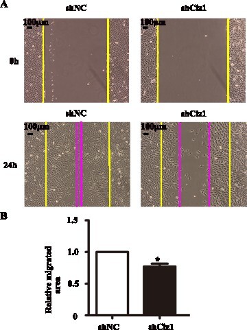 Figure 4. Knockdown of CIZ1 inhibited VSMCs’ migration. (a) Representative image of wound healing assay of VSMCs infected with Ciz1-shRNA lentiviral particles. (b) Bar graph of wound healing assay. n = 3, *, P < .05.