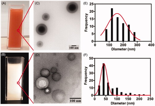 Figure 3. Photographs of DOX-lipiodol (A) and IRI-lipiodol (B) oil-in-water emulsions prepared using the Tessari method with the corresponding transmission electron microscopy images (C,D) and quantification of particle size of the DOX-lipiodol (E) and IRI-lipiodol (F) emulsions.