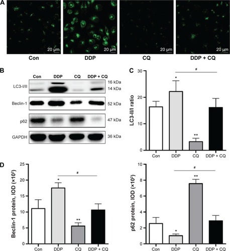 Figure 3 DDP induces autophagy in SW13 cells Autophagy Vesica.