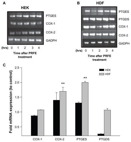 Figure 1 Effect of PRFE treatment on COX mRNA and prostaglandin D and E synthase expression in HEK and HDF in culture. (A and B) We evaluated the effect of PRFE treatment on levels of mRNA expression after 30 minutes of treatment with PRFE using standard conditions. Cells were harvested 4 hours following initiation of PRFE treatment and the RT-PCR products were analyzed by electrophoresis through 2% agarose gel. (C) Quantitative RT-PCR was used to determine the effect of PRFE on message levels for the various genes involved in prostaglandin synthesis (**P < 0.05 for control versus PRFE treatment) in HDF.
