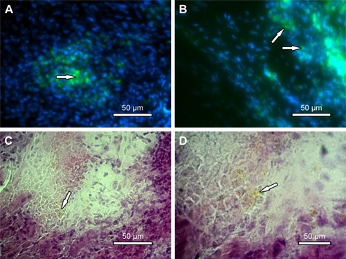 Figure 8 Myocardial tissue after cell therapy.Notes: (A and B) Nuclei stained with Hoechst 33,258 (blue) and NPC fluorescence (green), 200× and 400×, respectively (fluorescent optical microscopy). (C and D) H&E staining of myocardial tissue showing NPC clusters, 400× and 1,000×, respectively, scale bar: 50 µm. The white arrows are the NPC clusters.Abbreviation: NPC, curcumin-loaded polycaprolactone nanoparticles.