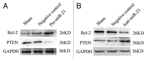 Figure 4. Expression of PTEN and BCL-2 in the A549 and A549/CDDP cells assessed by western blot after transfected with either scrambled or pre-miR-21 and anti-miR -21 expression. (A) The effects of miR-21 on the expression of PTEN and BCL-2 in A549 cells. Transfection of A549 cells with pre-miR-21 resulted in a decrease of PTEN levels and an increase of Bcl-2. (B) The effects of miR-21 on the expression of PTEN and BCL-2 in A549/CDDP cells. Transfection of A549/CDDP cells with anti-miR-21 resulted in an increase of PTEN levels and a decrease of Bcl-2. Sham: A549 or A549/CDDP without transfection; Negative control: A549 or A549/CDDP with transfection of Anti-miR and Pre-miR.