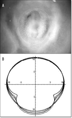 Figure 14 (A) A typical eight shaped area pellucida seen in the center of the yolk sac, surrounding the embryo, at day 1. The head is towards the top (12 o'clock), the tail towards the bottom. Blood islands are visible in the yolk sac The arteries will form the next day in the region of the nip of the eight. (Image courtesy of Lenoble F, U. Maastricht). (B) A typical theoretical blastodisc shape, if several deformation steps are performed (the AP axis is horizontal). A sector of the circle is actually sucked towards the nip where Kohler's sickle is exerting its force, while the tail extends caudaly. In this picture, the blastodisc adopts progressively an eight shape with a singular region in the region of the nip of the eight. In the center of this nip, one finds the center of the vortices seen in Figure 6B and C. This may be the origin of the prepattern of vitteline arteries. However, the calculated pattern is not as elongated as observed. In the actual embryo, there is obviously an additional extension in the AP direction, which is absent from this model. If we assume that this additional deformation does not change the global topology of the problem (mere change in aspect ratio), we can temptatively consider the center of pull as Hensen's node, and the two stressed areas anterior and posterior, as the presumptive primitive streak, and presumptive embryo body (horizontal gray lobes in Figure 9C. A likely reason why they undergo differente fates after cracking is in that the anterior part is not delaminated.