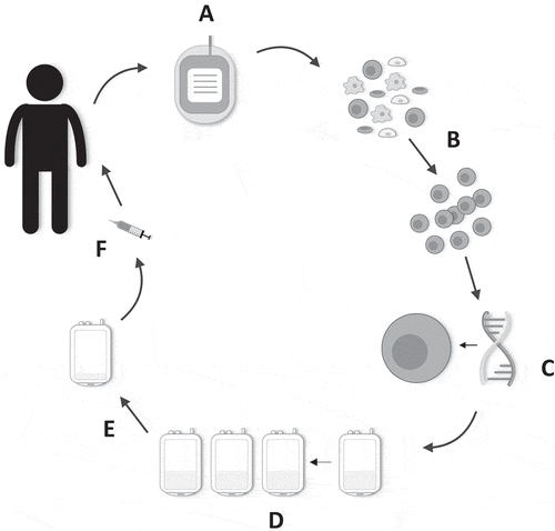 Figure 2. Manufacture of T4 immunotherapy. (a) 40–120 mL of whole blood is harvested from the patient. (b) Patient-derived peripheral blood mononuclear cells are isolated and activated. (c) Gene transfer is performed after 48 h. (d) Preferential expansion and enrichment of T4+ T-cells ex vivo is achieved with the addition of IL-4 to the cell culture bags. (e) Directly prior to administration, the cell culture is volume-reduced. (f) Cells are contained in a final 1–4 mL dosing volume and drawn up into a syringe. The dose is administered intratumorally using ultrasound guidance where required.
