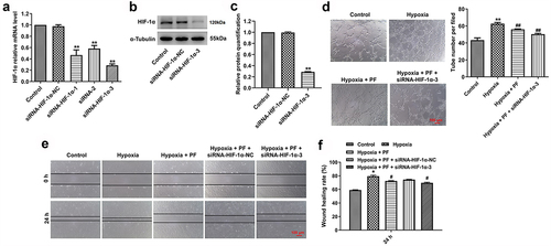 Figure 4. Knockdown of HIF-1α enhanced the anti-angiogenesis effect of PF on HRCECs under hypoxia. (a) HRCECs were treated with HIF-1α siRNAs for 24 h, the level of HIF-1α was detected with RT-qPCR. (b, c) HRCECs were treated with HIF-1α siRNA3 for 24 h, the level of HIF-1α was measured with western blot. (D, E and F) HRCECs were treated with PF or/and HIF-1α siRNA3 for 24 h under hypoxia, the angiogenesis and migration of cells were detected with tube formatting or transwell assay, respectively. *P < 0.05, **P < 0.01 compared with the control group; #P < 0.05, ##P < 0.01 compared with the hypoxia group; n = 3.