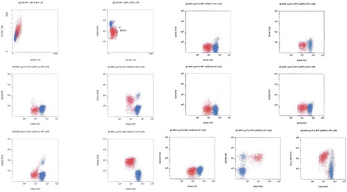 Figure 1 Malignant cells (red) show large size as compared to normal lymphocytes and dim expression of CD45. Their phenotype is CD19+, CD20−+, CD10−, CD34++, CD79a++, MPO++, HLA-DR+, and CD117−. Myeloid markers CD13, CD14, CD15, and CD33 are all negative.