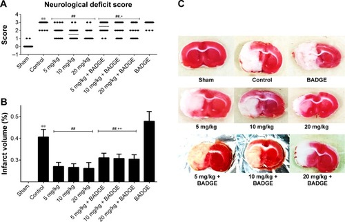 Figure 1 Effects of UA on neurological deficit scores and the infarct volume.