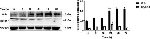 Figure 4 Western blotting was used to detect the Col-I and Beclin-1 protein expression in oral mucosal FBs after different PDGF-BB stimulation times. ***Indicates the comparison of Col-I in the 24-h group with that in the 6- and 12-h groups; ***P < 0.001. *Indicates the comparison of Col-I in the 48- and 72-h groups with that in the 24-h group; *P < 0.05. #Indicates the comparison of Beclin-1 in the 24-h group with that in the rest of the time groups; #P < 0.05.