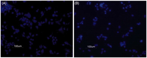 Figure 2. DAPI stained control and drug-treated cells. SW480 human colon cancer cells were treated with an alkaloid and stained with DAPI as described in methods. (A) Cells treated with 0.1% DMSO in media alone was taken as control. (B) Cells treated with 5 μg/mL 8-methoxydihydrosanguinarine.