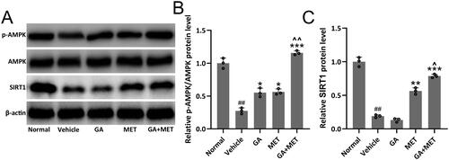 Figure 6. Effects of metformin combined with gallic acid treatment on renal AMPK/SIRT1 signaling pathway in mice model of diabetic nephropathy. Western blotting was used to measure the protein expressions of p-AMPK, AMPK and SIRT1 (A) and the relative expressions were normalized to normal (B and C). β-actin was used as a loading control. The data were gotten from three repeated experiments using renal homogenate from each group including eight mice. Data are presented as mean ± SD. ##p < 0.01, ###p < 0.001 compared to normal. *p < 0.05, **p < 0.01, ***p < 0.001 compared to vehicle. ^p < 0.05 compared to MET group.