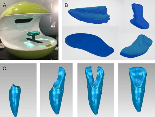Figure 3. (A) Scanning of the fragmented tooth pieces using optical scanner. (B) 3D model obtained in Standard Tessellation Language (STL) format. (C) Multi-point registration performed manually, fragmented.