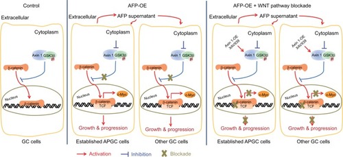 Figure 6 Representation of targeting Wnt pathways responsible for AFP-associated malignancy in APGC.Notes: Compared to the control, AFP overexpression promoted AFP-supernatant secretion, which activated canonical Wnt signaling (marked by inactive destruction complex including GSK3β dephosphorylation/inactivation, and reduced Axin 1, increased active β-catenin, augmented TCF transcriptional activity and upregulated target gene c-MYC) to enhance growth and metastasis in GC. Wnt-pathway blockade by Axin 1 overexpression or small-molecule inhibitor XAV939 (Axin1 stabilizer) impeded AFP-mediated malignancy in AFP-overexpressing GC, indicating therapeutic potentials of targeting Wnt pathways against APGC.Abbreviation: APGC, AFP-producing gastric cancer.