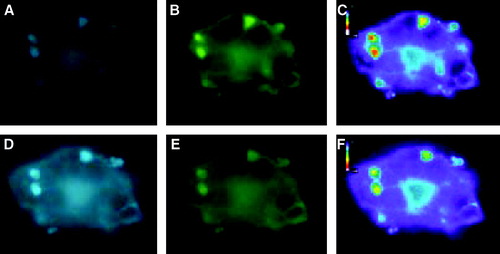 Figure 6.  Localization of CFP-Munc 18-1 and YFP-syntaxin in MDCK-cells and FRET-analysis with acceptor photobleaching. MDCK-cells were double transfected with CFP-Munc 18-1 and YFP-syntaxin wild-type. Thirty-six hours later localization of proteins was visualized with a CCD camera as decribed in Figure 5. The acceptor fluorophor was then photobleached with YFP-excitation for 3 min and additional images were taken at all wavelengths. Upper panel: before bleaching. Lower panel: after bleaching. (A, D) CFP-channel, (B, E) YFP-channel, (C, F) FRET-channel corrected for bleed-through (Net-FRET calculated as described in ‘Methods’).