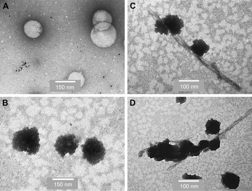 Figure 5 Incubation of PINPs with Aβ.Notes: Figure shows TEM images of negatively stained PINPs. (A) Individual PINPs before incubation with Aβ. (B) Individual PINPs after incubation with Aβ. (C) and (D) PINPs after extended incubation with Aβ bound to amyloid fibrils. Scale bars: A and B 150 nm, C and D 100 nm.Abbreviations: Aβ, amyloid-β; PINPs, peptide inhibitor nanoparticles; TEM, transmission electron microscope.