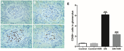Figure 3 Effect of HIR on macrophage infiltration in glomerulus of DN rats. (A–E) CD68 protein was detected in glomerulus of control (A), control + HIR (B), DN (C), and DN + HIR (D) groups, and CD68+ positive cells were quantified (E). Seven rats per group and 10 visual fields for each slice for statistics. ***Indicates P < 0.001 vs control group, and ###indicates P < 0.001 vs DN group.