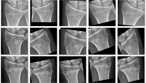 Figure 3. A typical example of the augmentation on 1 image from the annotated training dataset during the training course of Inception-v4.