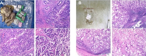 Figure 4 Photos of pathological images.