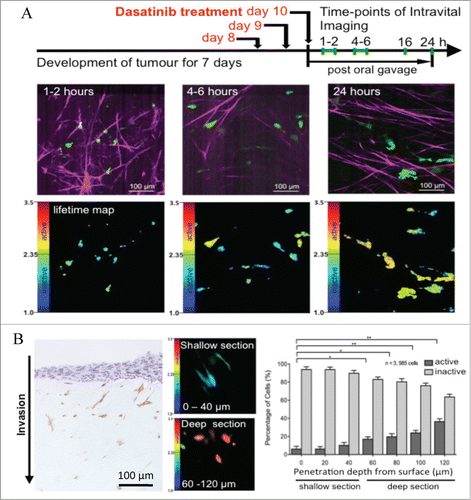 Figure 2. Monitoring targeted response to dasatinib in vivo and in vitro using FLIM-FRET. (A) Drug treatment regimen and imaging schedule (top) allowing for monitoring of dasatinib treatment efficacy in vivo over time, with collagen in magenta (detected by SHG imaging) and cells in green (middle) with corresponding lifetime maps of Src activity (bottom). (B) Src activity distribution in single cells in relation to penetration depth through collagen matrix in vitro, assessed by immunohistochemistry for phosphorylated Src (left, pSrc positive cells stain brown) or by FLIM-FRET with corresponding quantification at 20 μm resolution steps (right). Columns, mean; bars, standard errors; *, p = 0.027; **, p = 0.021; ***, p = 0.006; ****, p < 0.001 by unpaired Student t test. Figure, partially reproduced from original highlighted paper (Citation8 courtesy of Cancer Research).