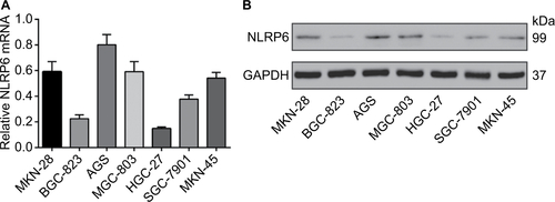 Figure S2 NLRP6 protein expression and mRNA expression in seven gastric cancer cell lines were determined by qRT-PCR (A) and Western blot (B) analysis, respectively.Abbreviation: qRT, quantitative reverse transcription.