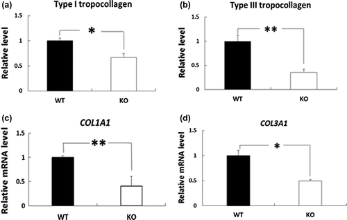 Figure 3. Effects of deletion of BDK on the levels of type I and type III tropocollagen proteins and COL1A1 and COL3A1 mRNAs in the skin. Type I tropocollagen (a) and type III tropocollagen (b) in the skin were evaluated by Western blotting and quantified. Density was expressed as a fold change relative to levels detected in WT mice. The mRNA levels of COL1A1 (c) and COL3A1 (d) in the rat skin were measured by quantitative PCR, and the values are expressed as the value relative to that of GAPDH. Data are expressed as mean ± SE (n = 4). *p < 0.05 and **p < 0.01 compared with WT mice.