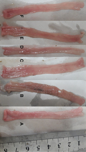 Figure 1 Macroscopic presentation of rat colons in treatment groups. Control (A) which shows intact colon, Colitis without treatment (B) which shows the highest level of tissue injuries like edema, erythema, ulcer, necrosis and thickening of tissue. Mastic oil: orally (C) and enema (D), prednisolone (E) and sesame oil (F) treated colons represents healing of ulcers and obvious improvement in tissue injuries.