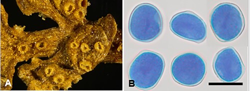 Figure 1. Aecidium ranunculi-maculati on Ranunculus maculatus: A, Aecia. B, Aeciospores (in aniline blue). Scale bar = 20 μm.