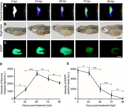 Figure 6 The chemotherapeutic effect of HCPT@NMOFs-RGD in HCC-bearing zebrafish. (A) Thermal imaging, (B) bright field, and (C) EGFP fluorescence of HCC-bearing zebrafish following HCPT@NMOFs-RGD treatment at 0 (control), 24, 48, 72, and 96 hours post treatment (hpt). (D) Statistical analysis of the intensity of thermal imaging (n=3 at each time point; ANOVA, *P<0.05, **P<0.01, ***P<0.001). (E) Statistical analysis of the intensity of EGFP-positive areas (n=3 at each time point; ANOVA, *P<0.05, **P<0.01, ***P<0.001). Scale bar in (B and C): 200 μm.
