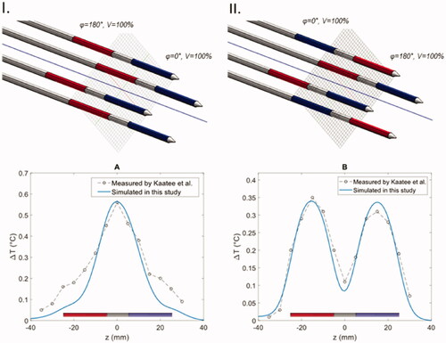 Figure 4. Comparison between simulated temperatures (blue line) and temperature measurements (points and dashed line) in two experiments with the MECS dual electrode applicators with different phase configurations. (I) In all applicators the distal and proximal electrodes have a 180° phase difference. (II) The power phase is inverted for two diagonal electrodes.