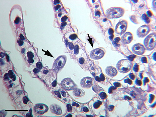 Figure 3. Hyalophysa chattoni (arrows) attached to the gills of grass shrimp, Palaemonetes pugio, collected in coastal Georgia (USA). Ciliates have not invaded host tissue nor elicited a host cellular response. H & E. Scale bar 50 µm.