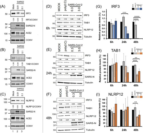 Figure 5. IRF3, TAB1 and NLRP12 are decreased upon infection with SARS-CoV-2 in 293T-ACE2 cells, in two independent laboratories. (A–C) 293T-ACE2 cells were infected with SARS-CoV-2 and analysed for viral and host protein levels 72 h post-infection. (D–I) Independently, stable 293T-ACE2 were infected with icSARS-CoV-2 mNeonGreen) and the levels of IRF3, TAB1 And NLRP12 were visualized by Western Blotting at 6 h (D), 24 h (E) and 48 h (F).(G–I): Protein levels measured by densitometry for IRF3 (G), TAB1 (H) and NLRP12 (I) and plotted for the Mock, poly(I:C) and SARS-CoV-2 infection at 6 h, 24 h and 48 h.