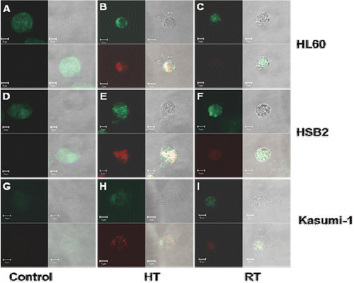 Figure 2. Localization and expression of Bcl-2 and Bax. Images of Bcl-2 (green fluorescent) and Bax (red fluorescent) proteins in HL60, HSB2 and Kasumi-1 cells. Samples were taken of untreated control cells and 2 h after heat treatment (HT) or irradiation (RT). The cells were fixed and stained as described in Materials and methods. Each confocal microscope image (a-i) is built up by 4 pictures namely Bcl-2 alone, bright field, Bax alone and overlay of Bcl-2 and Bax (from left to right, top to bottom). Bax and Bcl-2 fluorescence intensities were quantified using ImageJ software corrected for the surface area and compared to the fluorescence intensities of control cells, see results. Images are representative of three independent experiments.