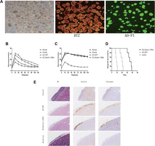 Figure 3 DCs transduced with LV-Dectin-1-RNAi-GFP prolonged the islet allografts survival. (A) Purified islets isolated from the perfusion, digestion, and purification procedure. The purity of islets was evaluated by DTZ staining and the activity was evaluated by AO-PI staining (×40). (B) Intraperitoneal glucose tolerance tests (IPGTTs) were performed on day 7 post-transplantation to test recipient glucose tolerance after 4–6 h of fasting. (C) IPGTTs were repeated after the removal of islet-bearing kidney to confirm recipient blood glucose response was islet allograft dependent. (The upper limit of the blood glucose meter is 33.3 mmol/L, and if the blood glucose level was above the limit it was recorded as 33.3 mmol/L. Data are expressed as mean only.). (D) Survival curve of islet grafts. Graft survival between groups of PBS control, DC-GFP, and DC-Dectin-1-RNAi was compared with Kaplan–Meier analysis (n = 5 animals/group). (E) On day 7 and rejection after transplantation, kidneys were removed and stained with the indicated markers. DC-Dectin-1-RNAi treated recipients displayed higher expression of insulin and glucagon compared to the other groups, indicating greater function and survival of islet grafts (× 200).