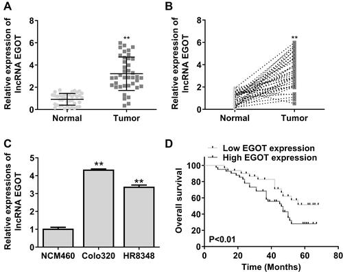 Figure 1 EGOT expression in rectal cancer tissues and cell lines. (A and B) Detection of EGOT expression in rectal cancer tissues and paired normal tissues by qRT-PCR (n = 50). (C) The expression of EGOT in rectal cancer cell lines. (D) Kaplan–Meier survival analysis of EGOT expression. N = 3. **p < 0.01.