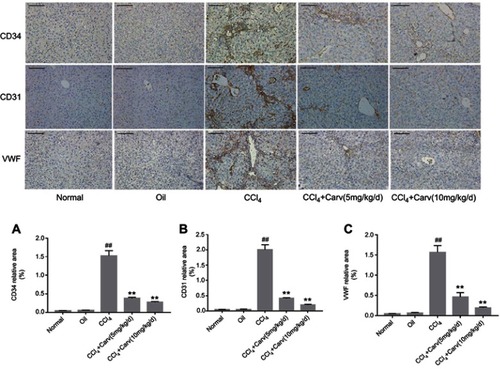 Figure 6 (A) Expression of CD34 by immunohistochemical staining (magnification ×200). (B) Expression of CD31 by immunohistochemical staining (magnification ×200). (C) Expression of VWF by immunohistochemical staining (magnification ×200). Scale bars: 100 μm. ##P<0.01 vs oil group; **P<0.01 vs CCl4 group; P<0.01 CCl4+Carv (5 mg/kg/d) group vs CCl4+Carv (10 mg/kg/d) group. Group 1, normal; group 2, oil; group 3, CCl4; group 4, CCl4+Carv (5 mg/kg/d); group 5, CCl4+Carv (10 mg/kg/d). Abbreviations: CCl4, carbon tetrachloride; Carv, carvedilol; VWF, von Willebrand factor.