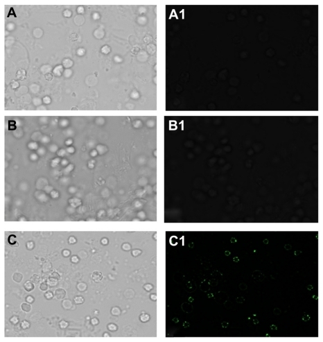 Figure 7 Fluorescence microscopy of tumor cells employing gold nanoparticle conjugated with antibody-generated against liver tumor cell surface proteins. (A and A1) liver tumor cells only (B and B1) Nonspecific antibody incubated with liver cancer cell captured by using phase contrast and fluorescein isothiocyanate filter, (C and C1) gold nanoparticles conjugated with liver cancer cell surface-specific antibodies upon their incubation with gold particles, phase contrast and fluorescein isothiocyanate filter images.