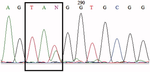 Figure 2. Sequencing result of the α2-globin gene in the father showing heterozygosity for codon 24 (HBA2: c.75T > A).