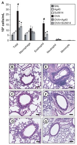 Figure 1 Effect of silver NPs on bronchial inflammation in ovalbumin-sensitized and ovalbumin-challenged mice. Sampling was performed 48 hours after the final challenge in saline-inhaled mice administered saline (SAL), saline-inhaled mice administered 40 mg/kg of silver NPs (Ag40) or SU5614 (SU5614), ovalbumin-inhaled mice administered saline (OVA), and ovalbumin-inhaled mice administered 40 mg/kg of silver NPs (OVA+Ag40) or SU5614 (OVA+SU5614). (A) The number of total and differential cellular components of BAL fluids. Bars indicate the mean ± standard error of the mean for eight mice per group in four to six independent experiments. (B–G) Representative of H&E-stained sections of the lungs.Notes: *P < 0.05 versus OVA; #P < 0.05 versus SAL. Bars indicate scale of 50 μm.Abbreviations: BAL, bronchoalveolar lavage; H&E, hematoxylin and eosin; NP, nanoparticle.